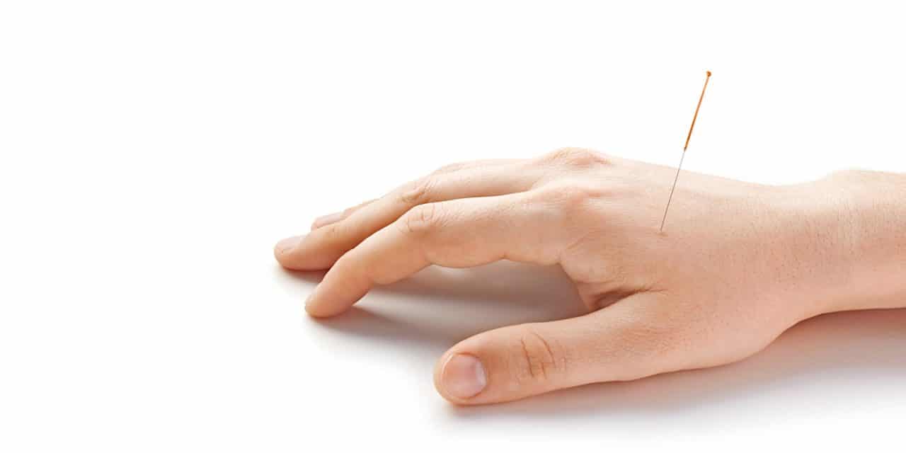 طب سوزنی,نگاه کلی به درمان با طب سوزنی